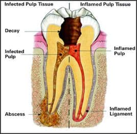 tooth.jpg